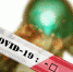 COVID-19 подтвердили еще у 302 человек в Коми - KomiOnline.Ru